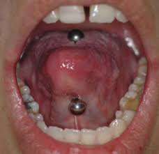 Body modification via tattooing and piercing has been an increasingly popular means of expression in today's society. Body Modification An Overview Sciencedirect Topics