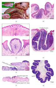 Image result for tonsilla palatina