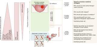 Some types of skin cancer are more dangerous than others, but if you have a spot. Accelerating Precision Medicine In Metastatic Prostate Cancer Nature Cancer