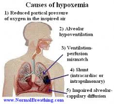 Chronic Hypoxemia In Pediatrics Pediatric Nursing Hypoxia Nursing Pediatrics
