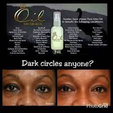 It takes more than mere shampooing and conditioning. Pin On Emu Oil