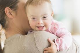 Down Syndrome Signs Symptoms And Characteristics