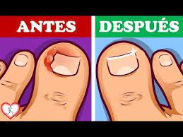 Pin En Deportivo Cali