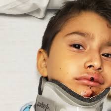 Elgin boy struck by 18-wheeler