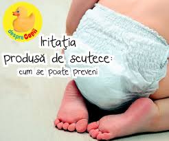 De la mare la mic. Iritatia De Scutec A Bebelusului Cauze Si Tratament Desprecopii Com