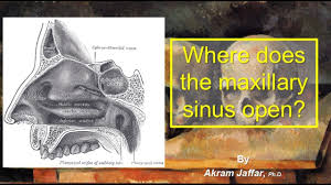 Image result for Maxillary Sinus