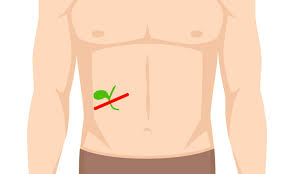 We did not find results for: What Is Gall Bladder Removal Surgery Health Plus