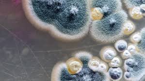 Resumen la mucormicosis es una micosis emergente, de elevada mortalidad. Covid 19 Is Mucormycosis Contagious Deccan Herald
