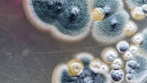#centroamérica | en honduras confirmaron el primer caso de mucormicosis, una infección potencialmente mortal, en un paciente recuperado de coronavirus. Covid 19 Is Mucormycosis Contagious Deccan Herald