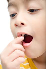 1,659 Denti Caduti Foto stock