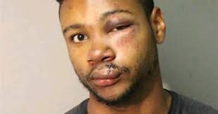 Plea ends Radford fight, drug cases