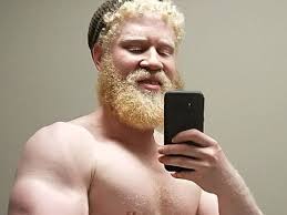 Dieser Fitness-Freak will stärkster Albino der Welt werden