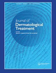 Stevens Johnson Syndrome And Toxic Epidermal Necrolysis An