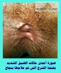 ما هو الدبر بالصور ما هو المقصود بفتحة الشرج بالصور كيف