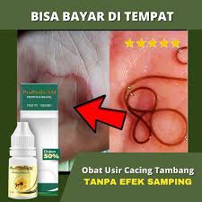 Di london antara tahun 1830 hingga 1900, cacing pita sudah dikaitkan dengan penurunan berat badan. Propolis Brazil Sm Obat Infeksi Cacing Tambang Herbal Gatal Gatal Ruam Kram Usus Diare Sakit Perut Cacing Pasir Cuta Neoud Larva Migrans Cacing Pasir Pada Kulit Kulit Ruam Kemerahan