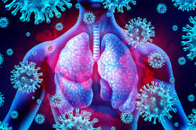 Lung cancer does not always cause symptoms. Research Shows Why Covid Pneumonia Is More Deadly
