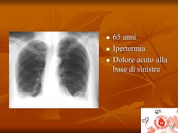 La diagnosi è molto affidabile. Embolia Polmonare Acuta Angio Tc Ppt Scaricare