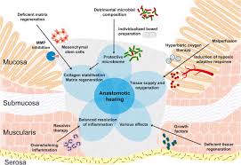 Whether larger colonic resections can undergo anastomosis, although the physiology would be expected to be the. Innovative Approaches For Induction Of Gastrointestinal Anastomotic Healing An Update On Experimental And Clinical Aspects Springerlink