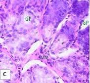 Image result for Gnidia stenophylla