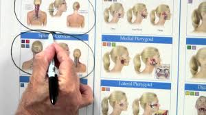 Head And Neck Trigger Point Wall Chart Youtube