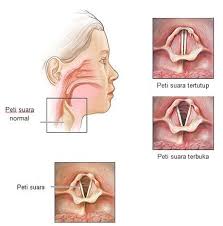 Layari laman kami www.doctoroncall.com untuk mendapat rawatan untuk gatal kemaluan. Hilang Suara Punca Simptom Dan Rawatan The Diagnosa