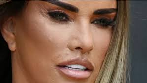 Darcey's Fox Eye surgery looks uneven. The right eye outer corner is turned  up too much. The same Comfortzone clinic did the "Barbie Touch Up" for  Katie Price (see last photo in
