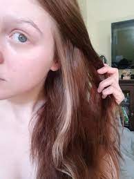 Poliosis Is The Localized Depigmentation Of Hair Follicles Resulting In A White Streak It Is Also Known As A Malle Mallen Streak White Streak In Hair Poliosis