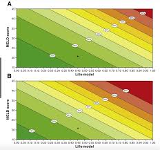Image result for Maddrey Discriminant Function