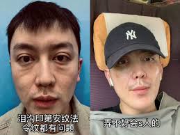 TikTok Star's Plastic Surgery Goes Wrong, Ages Him 20+ Years