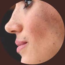 I've always had my suspicions over these photos, which were also taken by Chris  Allerton