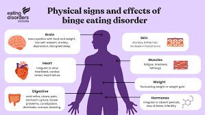 Image result for Binge-Eating Disorder