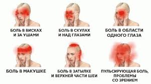 Golovnaya Bol Pri Shejnom Osteohondroze Simptomy I Lechenie Klinika Tkacheva Epifanova