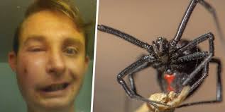 If a spider does get on a bed, usually no bite will result. Colorado Guy Bitten On Cheek By Black Widow Spider In His Sleep Nearly Blinded Unilad