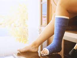 Penyebab telapak kaki sakit berikutnya adalah munculnya benjolan di tulang sendi jempol kaki. Cara Atasi Cedera Setelah Sembuh Dari Patah Tulang