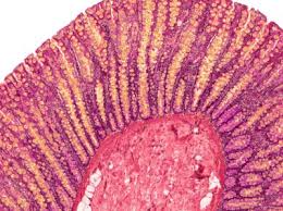 May 26, 2021 · the project hosts lose it over carrie bickmore's throwback snap. The Coronavirus Is Here To Stay Here S What That Means