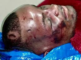 What makes these death even scarier is the shocking photos of the crime scenes. Black Man S Family Views Graphic Video Of In Custody Death Louisiana News Us News