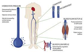 Pathophysiology Of Varicose Veins Radiology Key