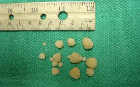 Bladder Stones In Dogs Vca Animal Hospital