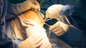 Maybe you would like to learn more about one of these? Acl Surgeries How To Avoid Surgery With Stem Cell Treatment