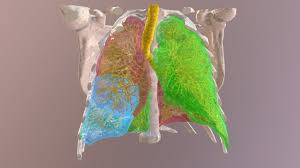 3d Model Of The Lungs Holoxica Via Sketchfab Lunges Model Human Lungs