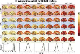Kcc For Different R Fmri Metrics Spatial Distribution Of