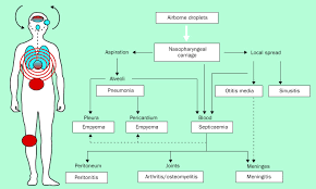Streptococcus Pneumoniae Colonisation The Key To Pneumococcal Disease The Lancet Infectious Diseases