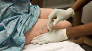 'moderna arm' is the latest vaccine reaction worrying people. Do I Have To Get The Covid Vaccine In My Arm The New York Times