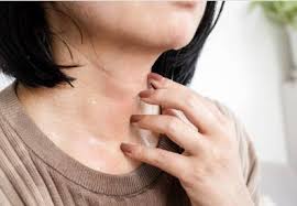 Image result for Intertrigo