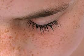 Repellent acne adalah sabun muka penghilang jerawat dan. 7 Cara Hilangkan Jeragat Di Muka Yang Berkesan Cubalah
