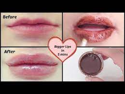 Check spelling or type a new query. How To Get Bigger And Fuller Lips Naturally In Just 5 Minutes Home Remedies Youtube Lips Fuller Fuller Lips Naturally Bigger Lips Naturally