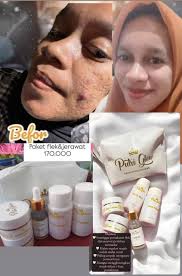 Awal Achmad Mentari Arifin