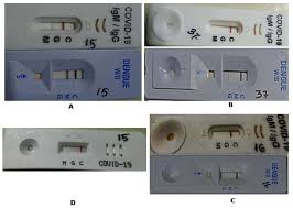 Dengue Antibodies Can Cross React With Sars Cov 2 And Vice Versa Antibody Detection Kits Can Give False Positive Results For Both Viruses In Regions Where Both Covid 19 And Dengue Co Exist Abstract Europe Pmc