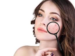 She would appear to listen and would remember nothing inconvenient, since her mind was sure (to be dwelling) on some problem connected with 9. How To Get Rid Of Pimples And Prevent Acne Naturally Femina In