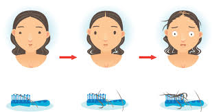 Taking a higher dose of thyroid medication will increase thyroid hormone status and improve hair growth. Thyroid And Hair Loss Thyroid Advisor